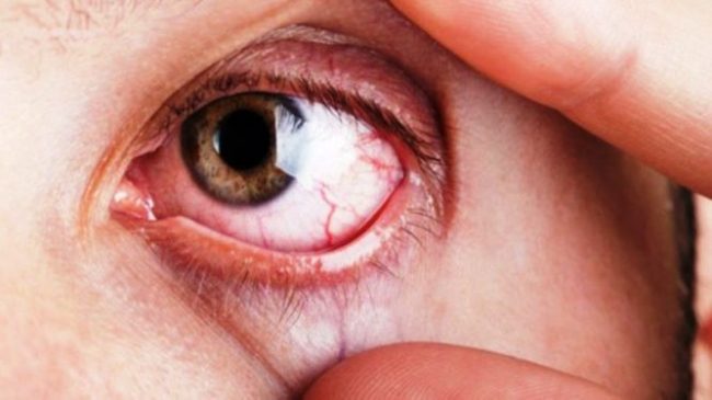 glaucoma-suele-aparecer-partir-anos_1323478340_94277269_667x375